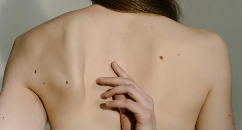 Zdjęcie ilustracyjne / Foto: pexels.com