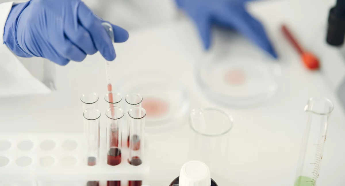 Polowanie na wieczne chemikalia: naukowcy z UMB opracują ultraczułą metodę wykrywania PFAS w krwi