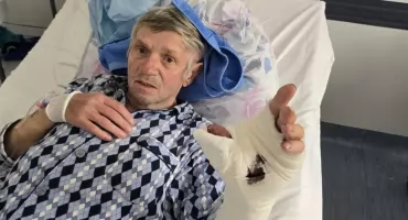 Palec albo papierosy: dramatyczna podróż 73-latka. Białostoccy ortopedzi uratowali mu kciuk pod jednym warunkiem