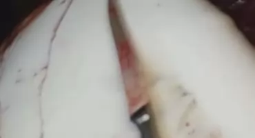 Wstrząsająca zbrodnia w Bielsku Podlaskim. Zabił matkę i opublikował zdjęcie w sieci!